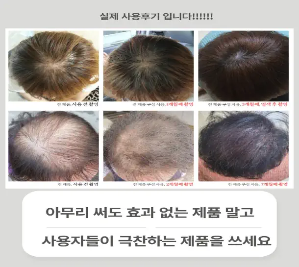 Trải Nghiệm Sự độc đáo Của Luub Rose - 9mart.vn