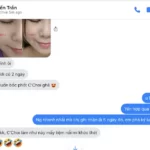 Review Dưỡng Mi Tế Bào Gốc C'choi - Bio-placenta Lash Serum - Punar - 9Mart.vn - Hình 10