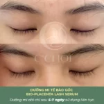 Review Dưỡng Mi Tế Bào Gốc C'choi - Bio-placenta Lash Serum - Punar - 9Mart.vn - Hình 13